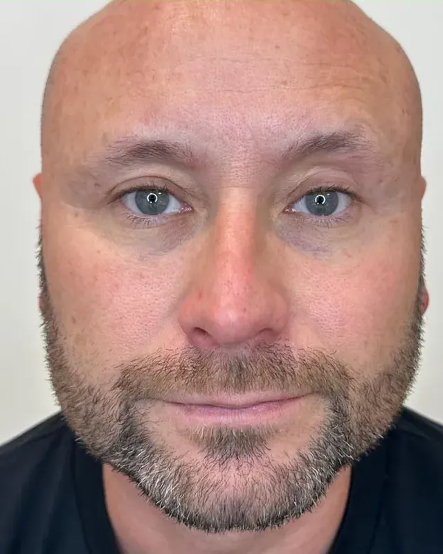 Antes: cejas masculinas sin tratar